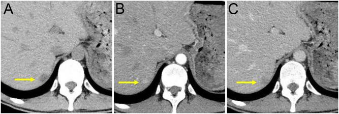 https://cdn.ncbi.nlm.nih.gov/pmc/blobs/5c5f/7576637/695b88c9bba7/EDM20-0057fig1.jpg