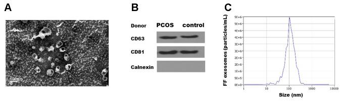 https://cdn.ncbi.nlm.nih.gov/pmc/blobs/5c63/7467373/8d4a8bccd909/aging-12-103602-g001.jpg