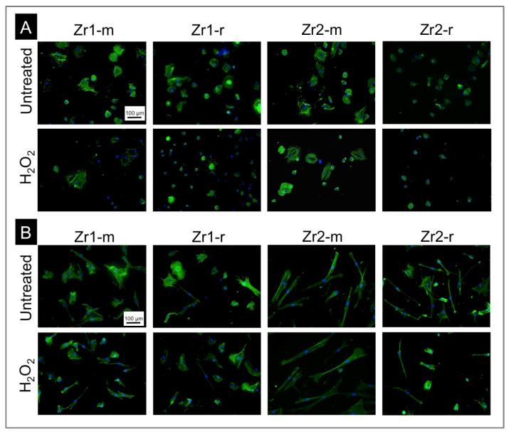 https://cdn.ncbi.nlm.nih.gov/pmc/blobs/5c66/9918077/a4c4e2bd81b9/materials-16-00961-g003.jpg
