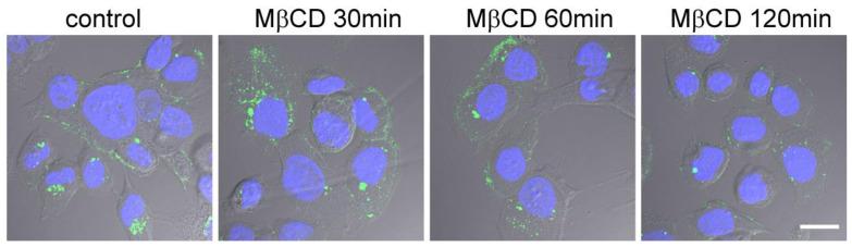 https://cdn.ncbi.nlm.nih.gov/pmc/blobs/5c6f/10361209/ef8cb0a10fb7/ijms-24-09029-g004.jpg