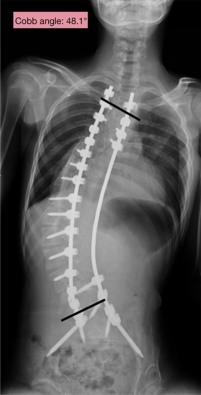 https://cdn.ncbi.nlm.nih.gov/pmc/blobs/5c78/11224787/730835e8a47e/jss-10-02-224-f2.jpg