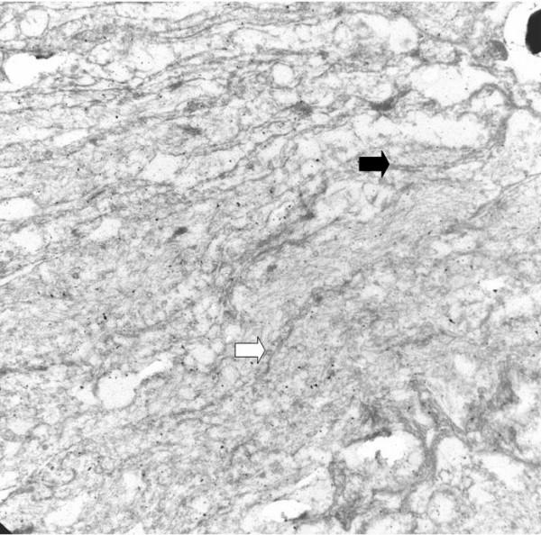 https://cdn.ncbi.nlm.nih.gov/pmc/blobs/5c7d/1543630/f9797f1b8416/1477-7819-4-39-3.jpg