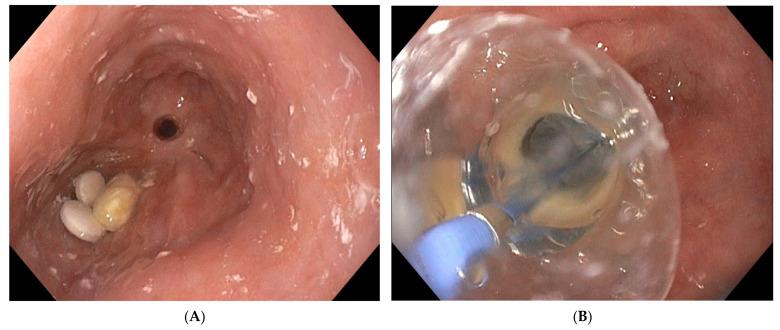 https://cdn.ncbi.nlm.nih.gov/pmc/blobs/5c83/10302082/c090012ad2fa/life-13-01412-g004.jpg