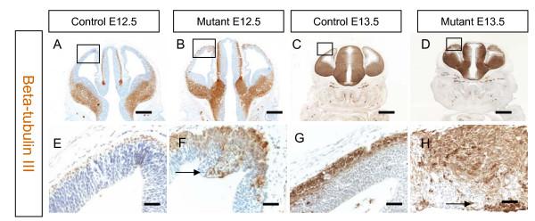 https://cdn.ncbi.nlm.nih.gov/pmc/blobs/5c87/2649069/c38c5e846f2e/1749-8104-4-3-2.jpg