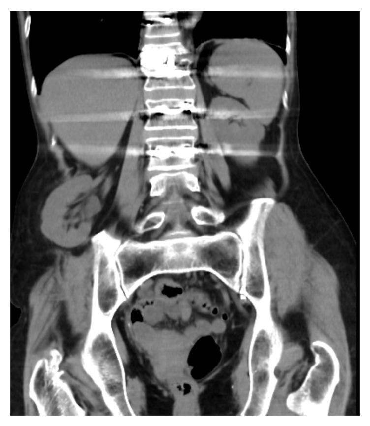 https://cdn.ncbi.nlm.nih.gov/pmc/blobs/5c89/5155106/34f1cb185826/CRIS2016-5365647.002.jpg