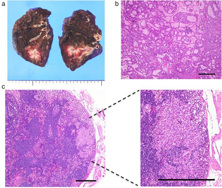 https://cdn.ncbi.nlm.nih.gov/pmc/blobs/5c98/9013649/d6d498efda39/TCA-13-1227-g001.jpg