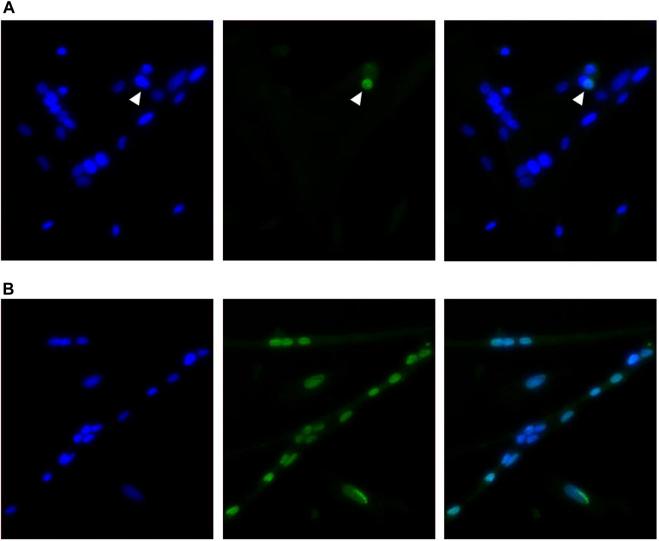 https://cdn.ncbi.nlm.nih.gov/pmc/blobs/5ca0/10687209/1499c9347ef6/fphys-14-1288809-g003.jpg
