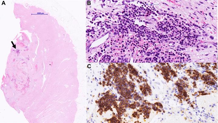 https://cdn.ncbi.nlm.nih.gov/pmc/blobs/5ca2/11830249/2d97b2b861c1/gr3.jpg