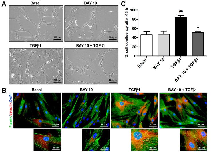 https://cdn.ncbi.nlm.nih.gov/pmc/blobs/5ca5/10887040/6a5a3e535e07/cells-13-00360-g002.jpg