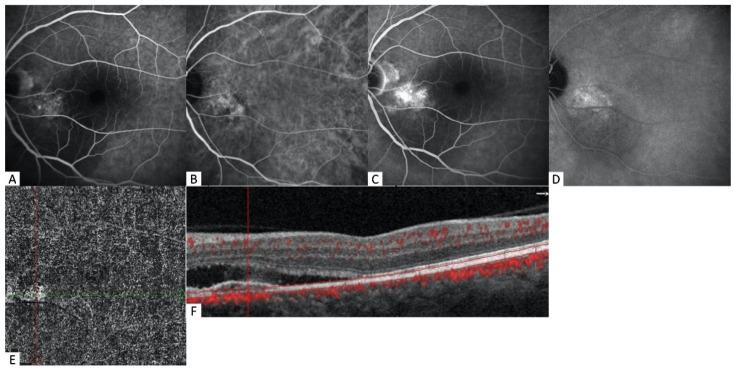 https://cdn.ncbi.nlm.nih.gov/pmc/blobs/5ca5/9222058/b050242d2ee1/diagnostics-12-01368-g004.jpg