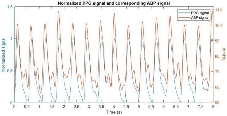 https://cdn.ncbi.nlm.nih.gov/pmc/blobs/5cad/9960464/55d1b3f8a936/sensors-23-02321-g002.jpg