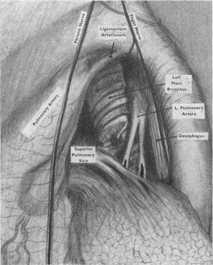 https://cdn.ncbi.nlm.nih.gov/pmc/blobs/5caf/2011584/c9ba94c0d173/archdisch01641-0019-a.jpg