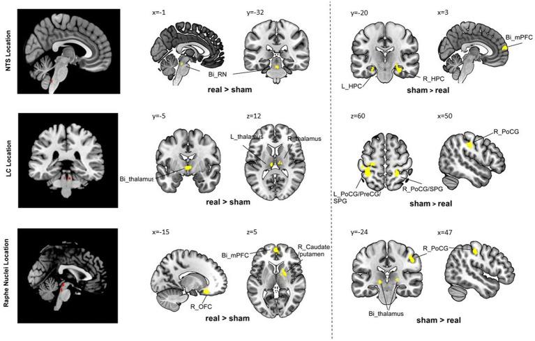 https://cdn.ncbi.nlm.nih.gov/pmc/blobs/5cb2/10275573/295aed086270/fnmol-16-1160006-g001.jpg