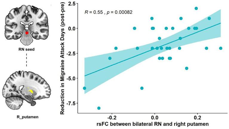 https://cdn.ncbi.nlm.nih.gov/pmc/blobs/5cb2/10275573/be9cd4b43c71/fnmol-16-1160006-g002.jpg