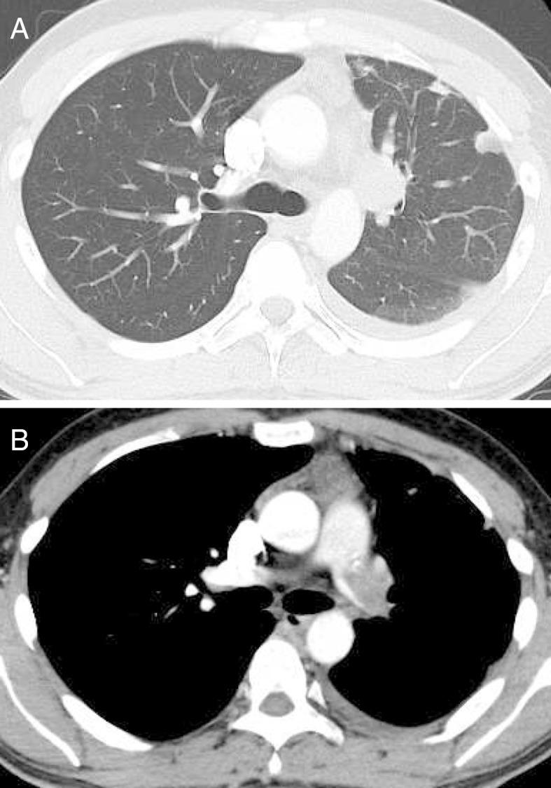 https://cdn.ncbi.nlm.nih.gov/pmc/blobs/5cb3/5709647/8828236cc703/1349-7235-56-2953-g001.jpg