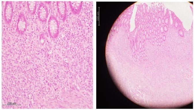 https://cdn.ncbi.nlm.nih.gov/pmc/blobs/5cb5/10131265/3d3370c67df5/ol-25-05-13789-g06.jpg