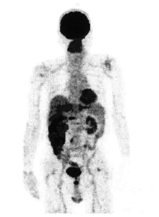 https://cdn.ncbi.nlm.nih.gov/pmc/blobs/5cb5/10131265/b95656e19716/ol-25-05-13789-g02.jpg