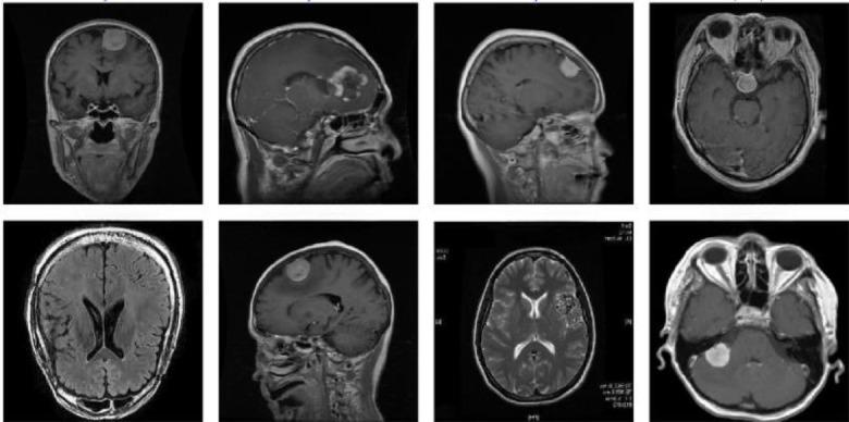 https://cdn.ncbi.nlm.nih.gov/pmc/blobs/5cb5/12402508/6582e8b1cef7/41598_2025_15604_Fig4_HTML.jpg