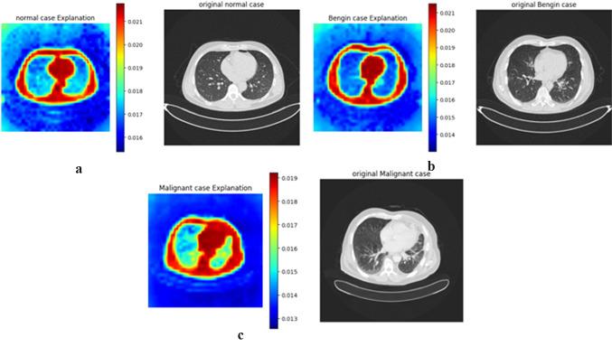 https://cdn.ncbi.nlm.nih.gov/pmc/blobs/5cb5/12402508/a8fef37e71a4/41598_2025_15604_Fig16_HTML.jpg