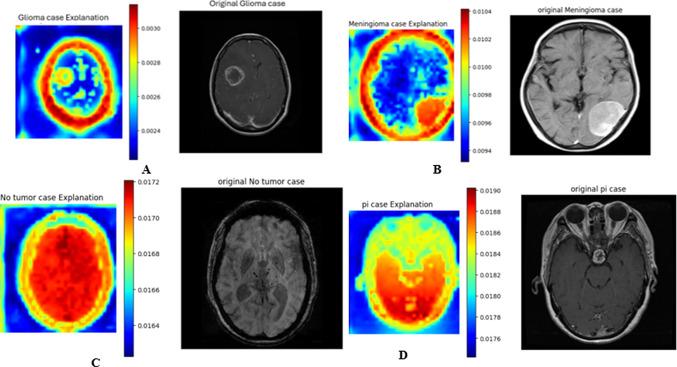 https://cdn.ncbi.nlm.nih.gov/pmc/blobs/5cb5/12402508/f90d6ea54f6c/41598_2025_15604_Fig18_HTML.jpg