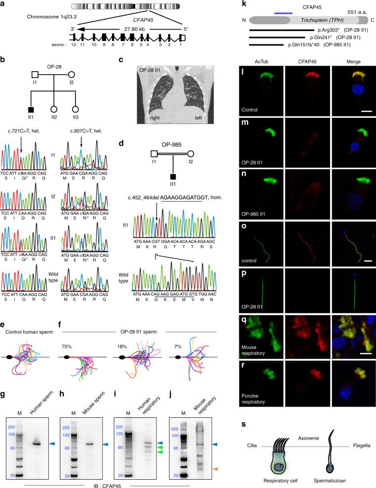 https://cdn.ncbi.nlm.nih.gov/pmc/blobs/5cba/7606486/859915390737/41467_2020_19113_Fig1_HTML.jpg