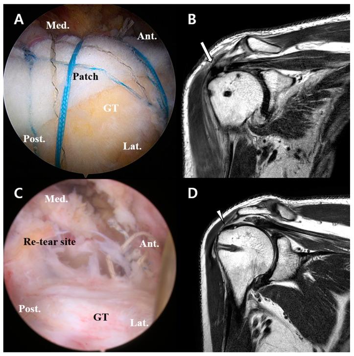 https://cdn.ncbi.nlm.nih.gov/pmc/blobs/5cbc/10252603/3122743ef044/diagnostics-13-01961-g002.jpg