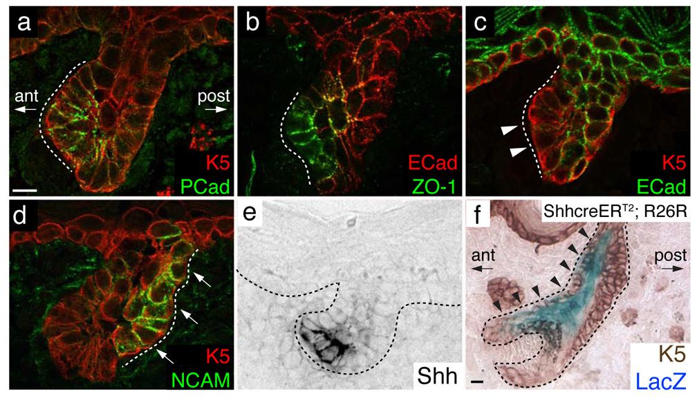 https://cdn.ncbi.nlm.nih.gov/pmc/blobs/5cc2/2607065/0a5a7f19adee/nihms68191f2.jpg