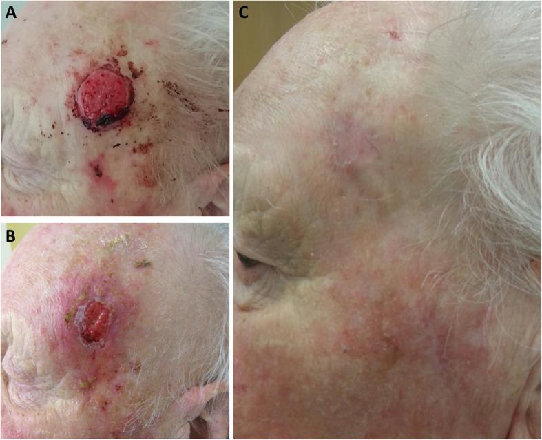 https://cdn.ncbi.nlm.nih.gov/pmc/blobs/5cca/7236131/018cb5724dd7/13014_2020_1563_Fig1_HTML.jpg