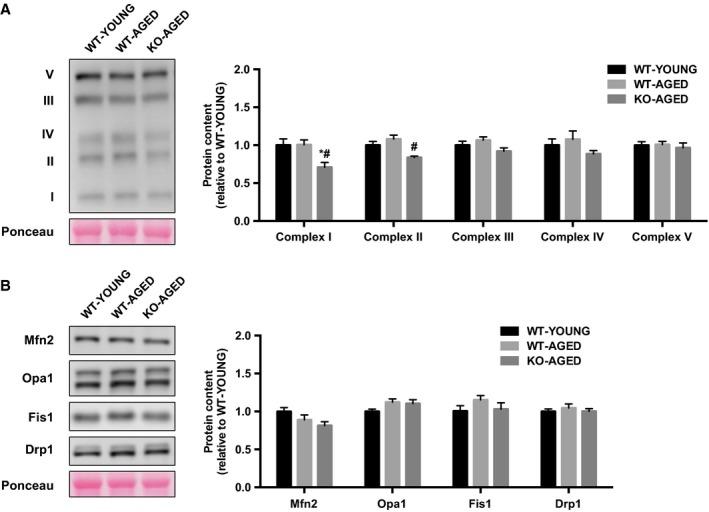 https://cdn.ncbi.nlm.nih.gov/pmc/blobs/5ccb/6372533/c945140d4628/PHY2-7-e13998-g007.jpg