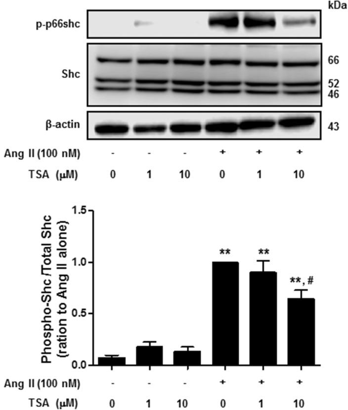 https://cdn.ncbi.nlm.nih.gov/pmc/blobs/5cd5/4553407/2d97f4fabf17/kjpp-19-467-g004.jpg