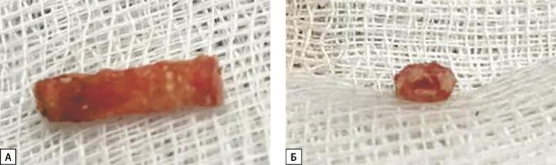 https://cdn.ncbi.nlm.nih.gov/pmc/blobs/5cd8/11931468/ab27b2df45e1/problendo-71-13360-g002.jpg