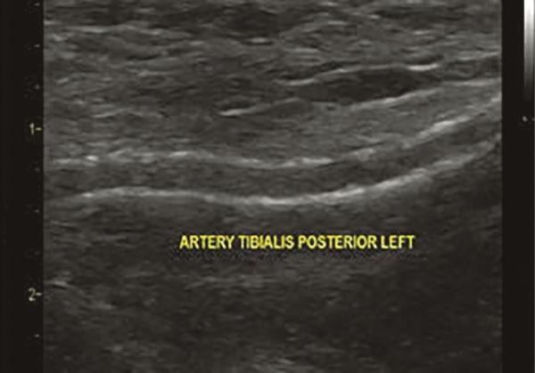 https://cdn.ncbi.nlm.nih.gov/pmc/blobs/5cd8/11931468/b1f7f0f1e0d1/problendo-71-13360-g001.jpg