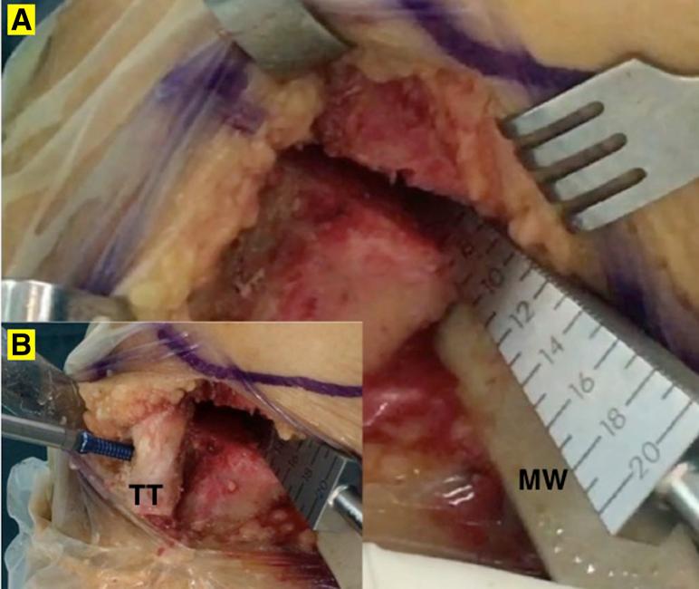 https://cdn.ncbi.nlm.nih.gov/pmc/blobs/5cd8/5765526/0c4e293e1989/gr5.jpg