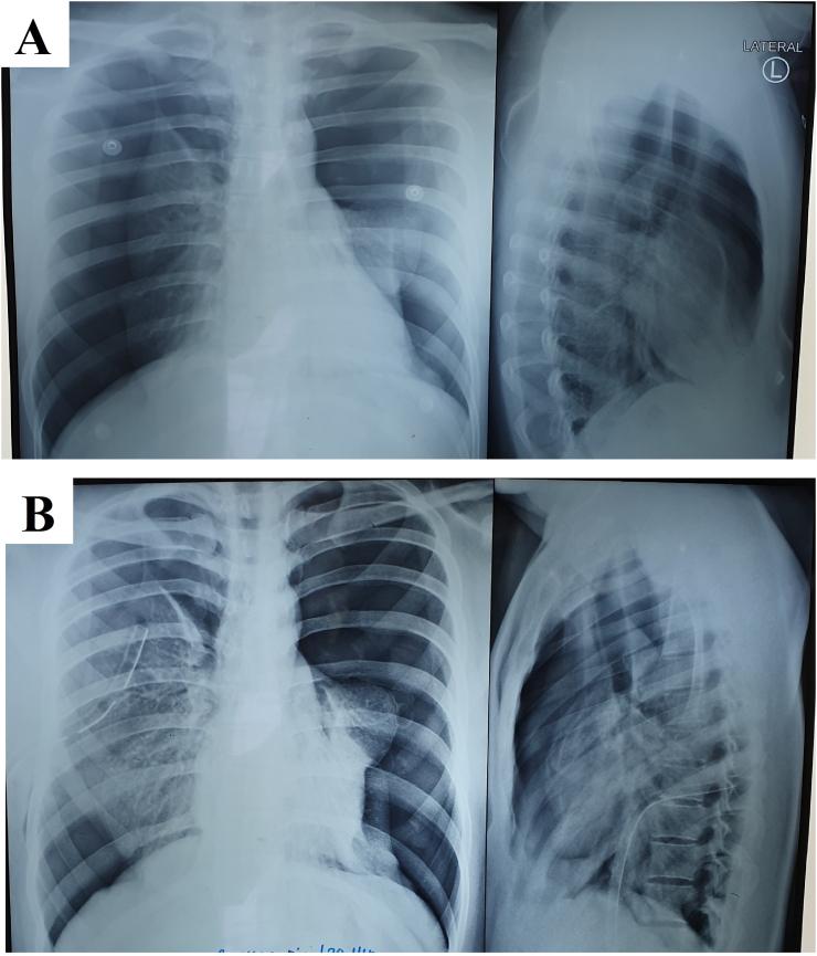https://cdn.ncbi.nlm.nih.gov/pmc/blobs/5cd9/8327650/adace26ab48a/gr1.jpg