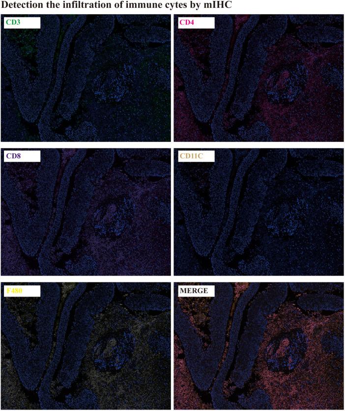 https://cdn.ncbi.nlm.nih.gov/pmc/blobs/5cdb/9614080/04d309338d50/fsurg-09-1004554-g004.jpg