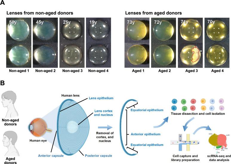 https://cdn.ncbi.nlm.nih.gov/pmc/blobs/5cde/12211975/1234bd02d730/13287_2025_4436_Fig1_HTML.jpg