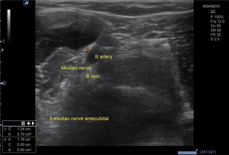 https://cdn.ncbi.nlm.nih.gov/pmc/blobs/5cdf/6187921/884dc7e0cf03/cia-13-1953Fig5.jpg