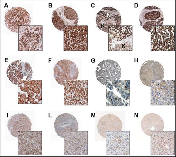 https://cdn.ncbi.nlm.nih.gov/pmc/blobs/5ce2/2680906/3b4157664f6a/1471-2407-9-125-2.jpg