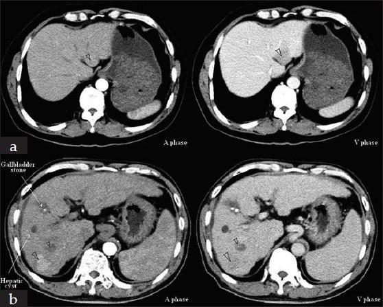 https://cdn.ncbi.nlm.nih.gov/pmc/blobs/5cea/3872615/a9c4e54d48ae/JRMS-18-726-g001.jpg