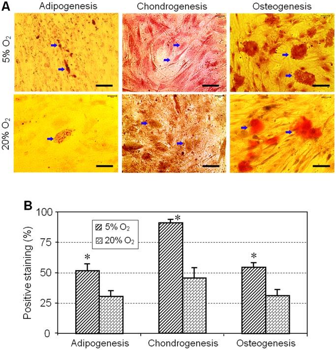 https://cdn.ncbi.nlm.nih.gov/pmc/blobs/5cec/3629026/04f492644bf2/pone.0061424.g006.jpg