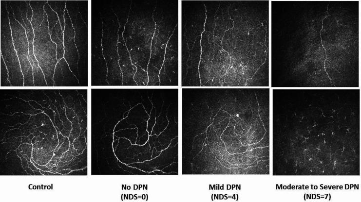 https://cdn.ncbi.nlm.nih.gov/pmc/blobs/5cf5/7754626/b5fca6c3075d/bmjdrc-2020-001801f01.jpg