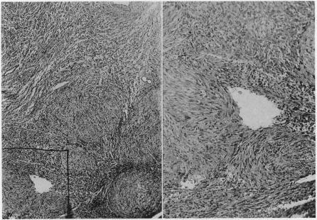 https://cdn.ncbi.nlm.nih.gov/pmc/blobs/5cf7/1390800/914ea60d768d/annsurg00558-0024-b.jpg