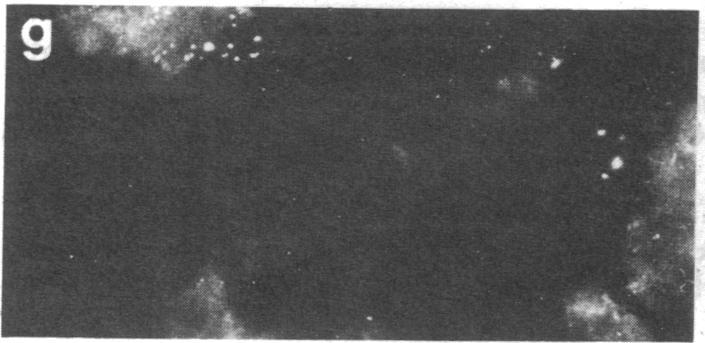 https://cdn.ncbi.nlm.nih.gov/pmc/blobs/5d01/319936/0796044b3f5f/pnas00653-0381-g.jpg