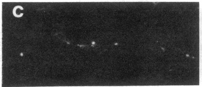 https://cdn.ncbi.nlm.nih.gov/pmc/blobs/5d01/319936/17859c0d2a0d/pnas00653-0380-d.jpg