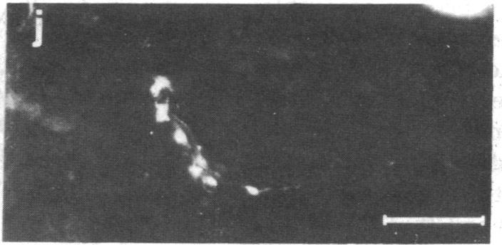 https://cdn.ncbi.nlm.nih.gov/pmc/blobs/5d01/319936/e0c56ac377b1/pnas00653-0381-j.jpg