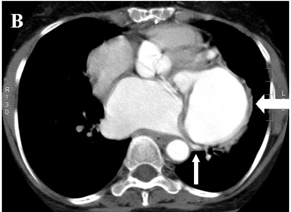 https://cdn.ncbi.nlm.nih.gov/pmc/blobs/5d02/2424049/5759bc44cac3/1749-8090-3-28-3.jpg