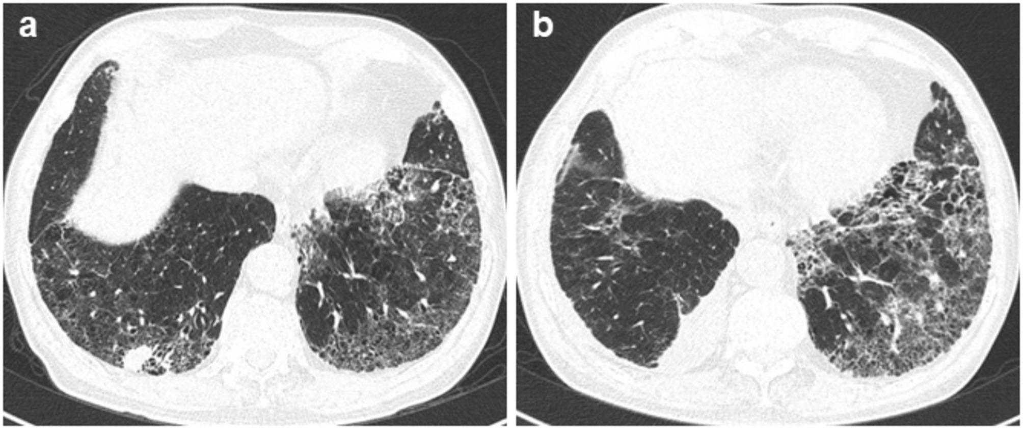 https://cdn.ncbi.nlm.nih.gov/pmc/blobs/5d08/12039160/950803993ba6/12890_2025_3680_Fig1_HTML.jpg