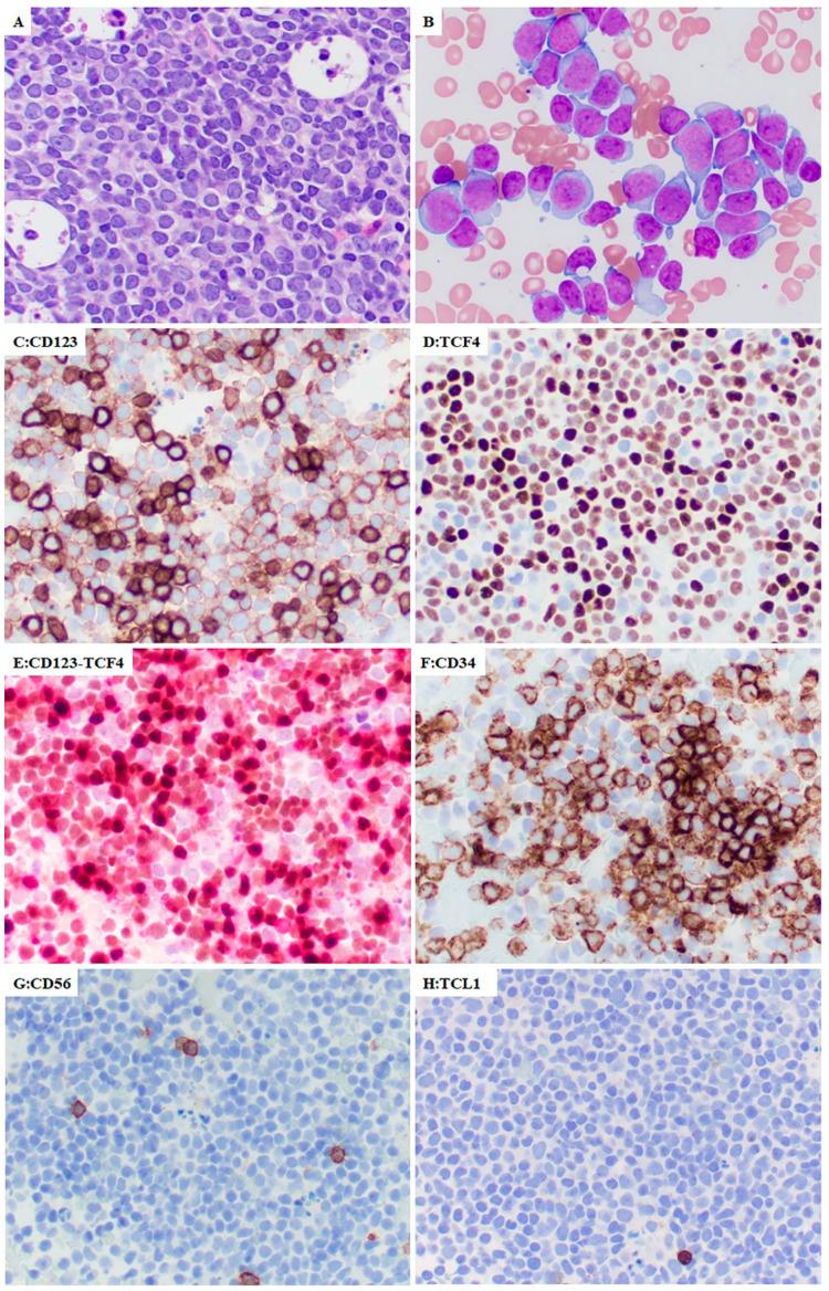 https://cdn.ncbi.nlm.nih.gov/pmc/blobs/5d0c/9324882/c4dd6de72b01/cancers-14-03375-g001.jpg
