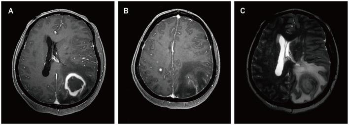 https://cdn.ncbi.nlm.nih.gov/pmc/blobs/5d0d/11133574/06cdf85dd9a2/fneur-15-1392691-g0006.jpg