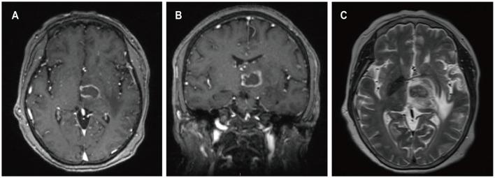 https://cdn.ncbi.nlm.nih.gov/pmc/blobs/5d0d/11133574/7231c2d6e64e/fneur-15-1392691-g0004.jpg